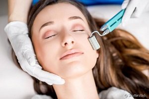 Microagulhamento facial