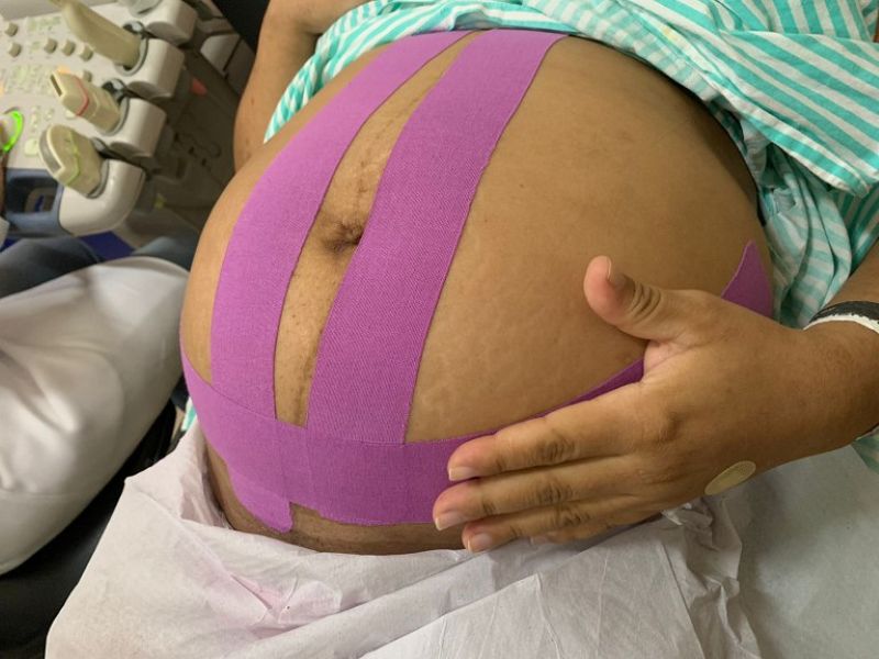 Tape gestacional — imagem 2 de 3